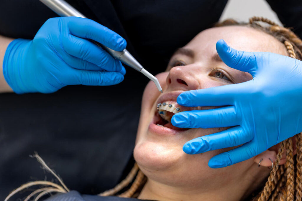 traitement orthodontique à l'âge adulte Tatiana Chirk